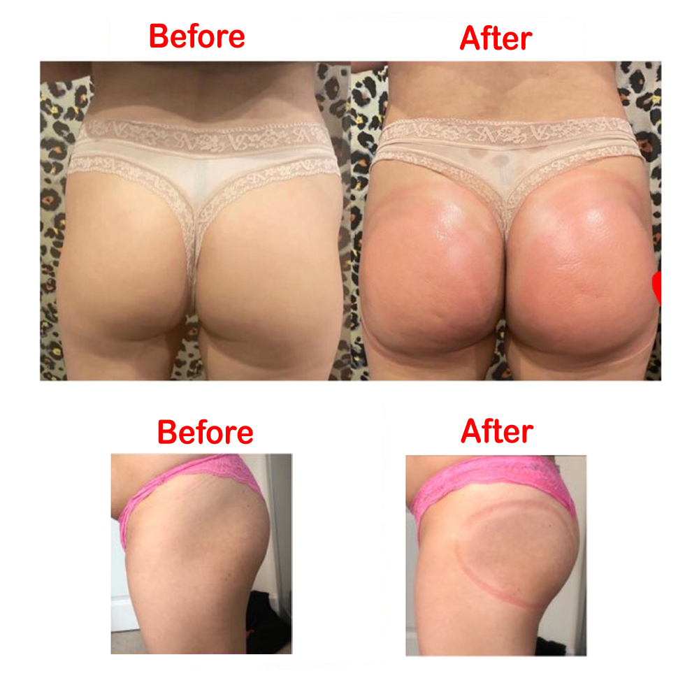 VamsLuna 2PCS 21 cm 크기 엉덩이 빨판  - Breast Pump 리뷰 및 가격